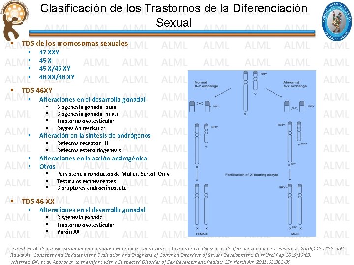 Clasificación de los Trastornos de la Diferenciación Sexual § TDS de los cromosomas sexuales Clasificación de los Trastornos de la Diferenciación Sexual § TDS de los cromosomas sexuales