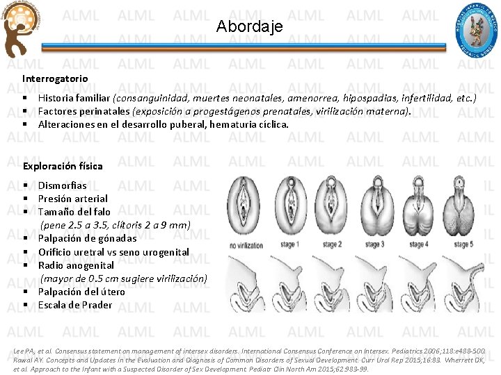 Abordaje Interrogatorio § Historia familiar (consanguinidad, muertes neonatales, amenorrea, hipospadias, infertilidad, etc. ) § Abordaje Interrogatorio § Historia familiar (consanguinidad, muertes neonatales, amenorrea, hipospadias, infertilidad, etc. ) §