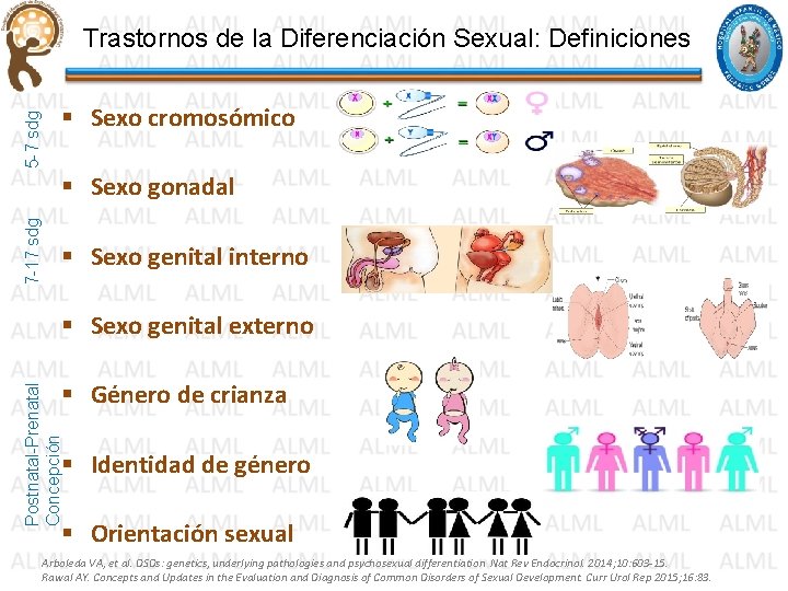 5 -7 sdg Trastornos de la Diferenciación Sexual: Definiciones § Sexo cromosómico 7 -17 5 -7 sdg Trastornos de la Diferenciación Sexual: Definiciones § Sexo cromosómico 7 -17
