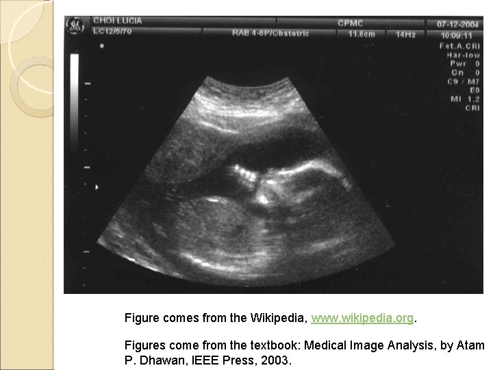 Figure comes from the Wikipedia, www. wikipedia. org. Figures come from the textbook: Medical