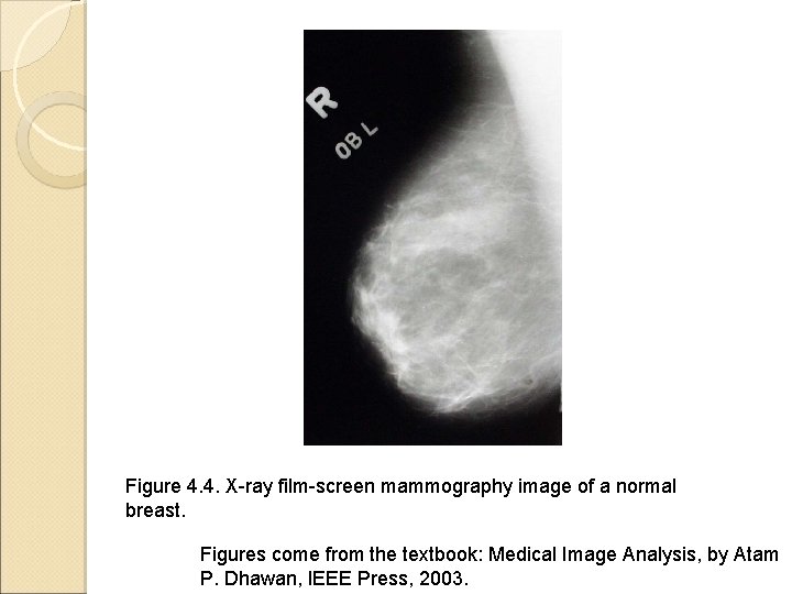 Figure 4. 4. X-ray film-screen mammography image of a normal breast. Figures come from