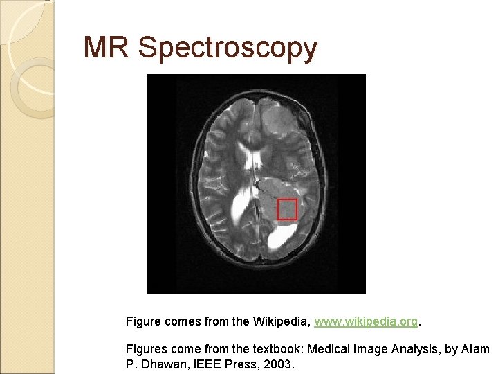 MR Spectroscopy Figure comes from the Wikipedia, www. wikipedia. org. Figures come from the