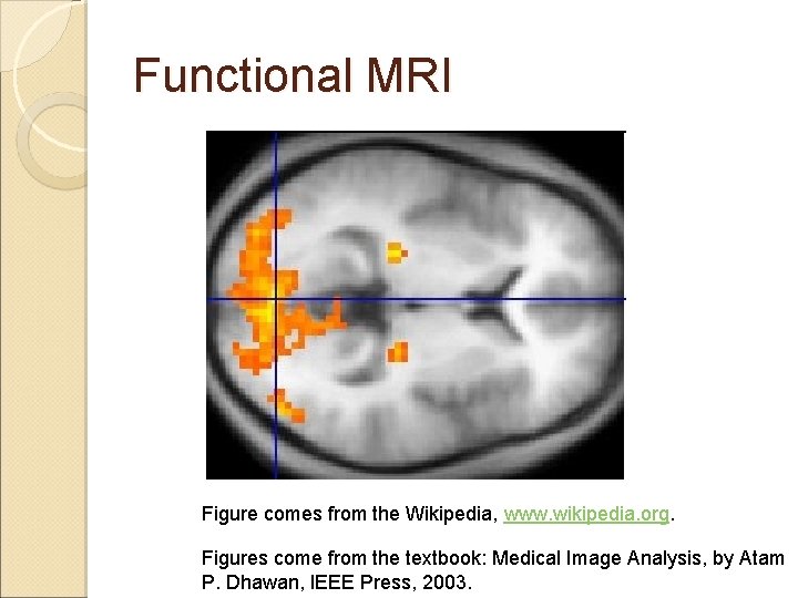 Functional MRI Figure comes from the Wikipedia, www. wikipedia. org. Figures come from the