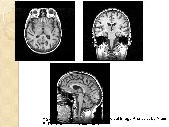 Figures come from the textbook: Medical Image Analysis, by Atam P. Dhawan, IEEE Press,