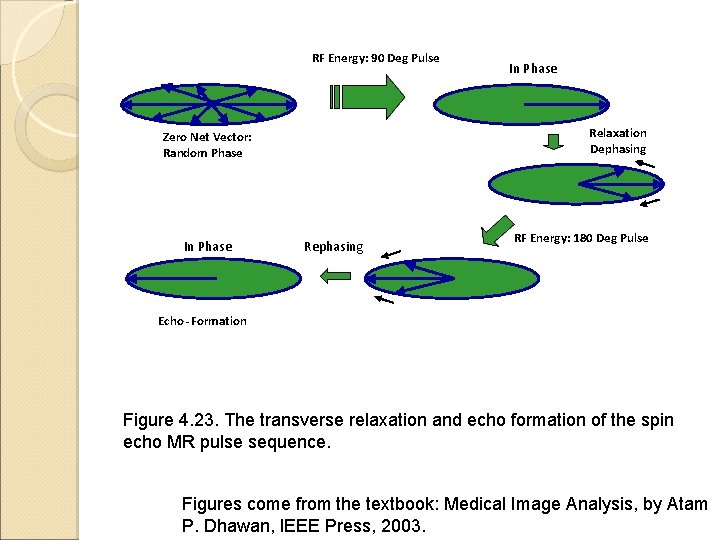 RF Energy: 90 Deg Pulse Relaxation Dephasing Zero Net Vector: Random Phase In Phase