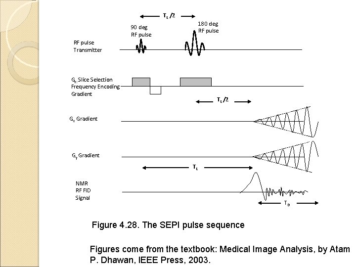 TE /2 180 deg RF pulse 90 deg RF pulse Transmitter Gz: Slice Selection TE /2 180 deg RF pulse 90 deg RF pulse Transmitter Gz: Slice Selection