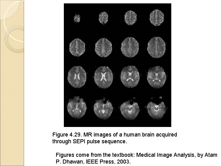 Figure 4. 29. MR images of a human brain acquired through SEPI pulse sequence.