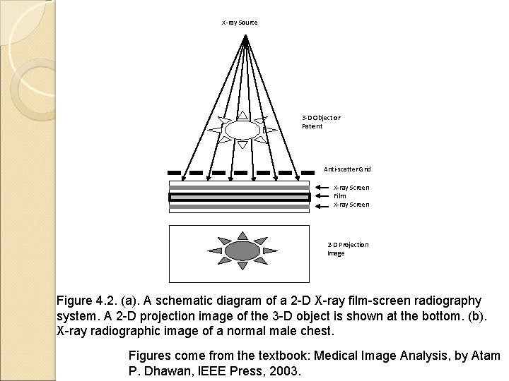 X-ray Source 3 -D Object or Patient Anti-scatter Grid X-ray Screen Film X-ray Screen