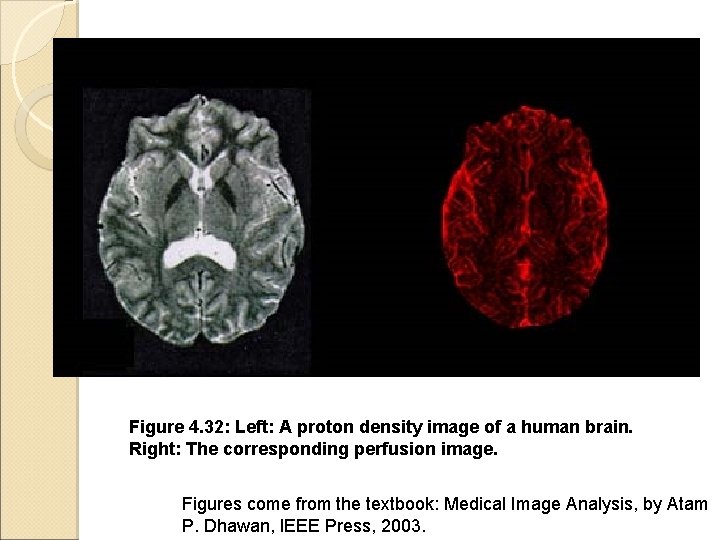 Figure 4. 32: Left: A proton density image of a human brain. Right: The