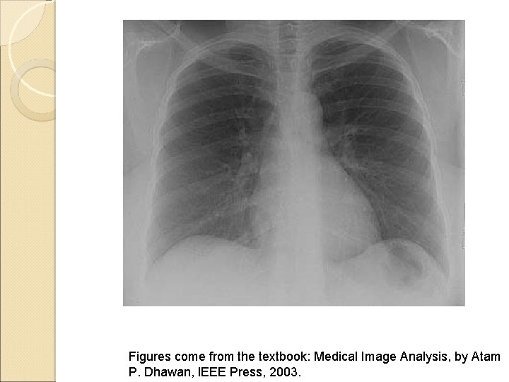 Figures come from the textbook: Medical Image Analysis, by Atam P. Dhawan, IEEE Press,