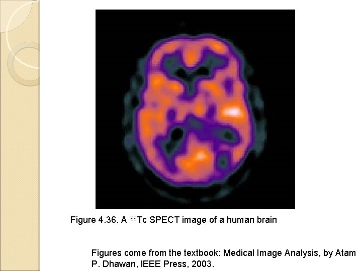 Figure 4. 36. A 99 Tc SPECT image of a human brain Figures come