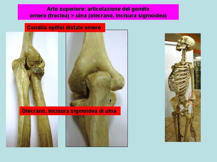 Arto superiore: articolazione del gomito omero (troclea) > ulna (olecrano, incisura sigmoidea) Condilo epifisi