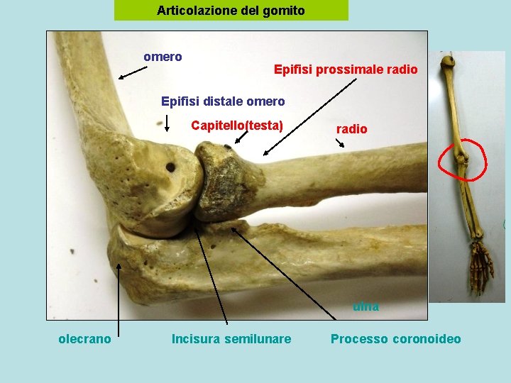 Articolazione del gomito omero Epifisi prossimale radio Epifisi distale omero Capitello(testa) radio ulna olecrano