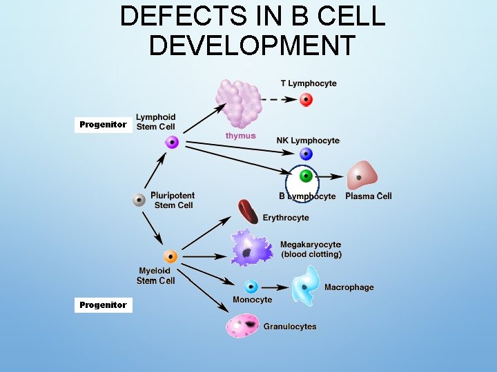 DEFECTS IN B CELL DEVELOPMENT Progenitor 