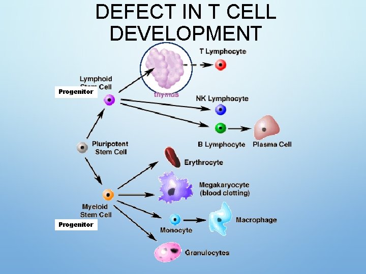 DEFECT IN T CELL DEVELOPMENT Progenitor 