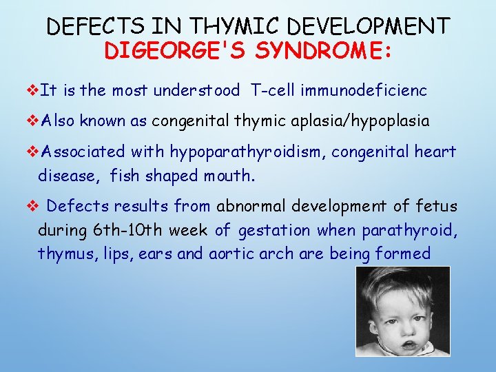 DEFECTS IN THYMIC DEVELOPMENT DIGEORGE'S SYNDROME: v. It is the most understood T-cell immunodeficienc