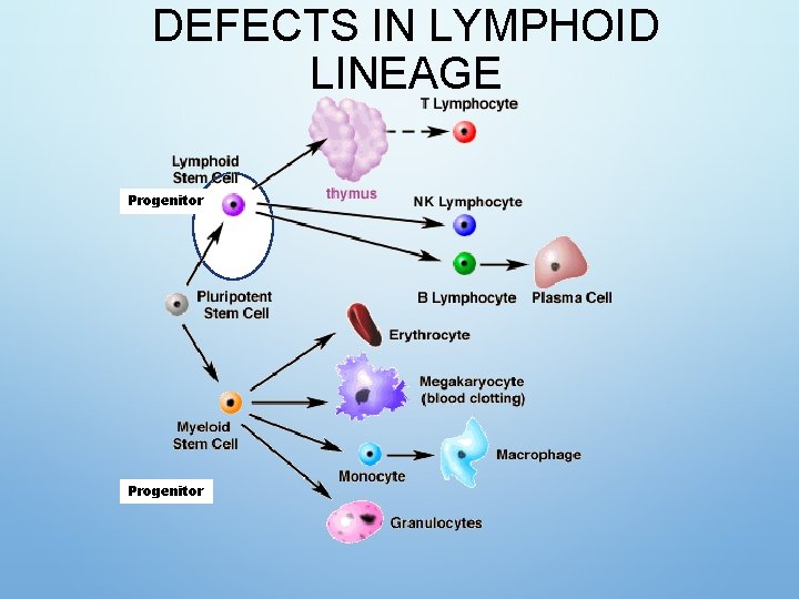 DEFECTS IN LYMPHOID LINEAGE Progenitor 