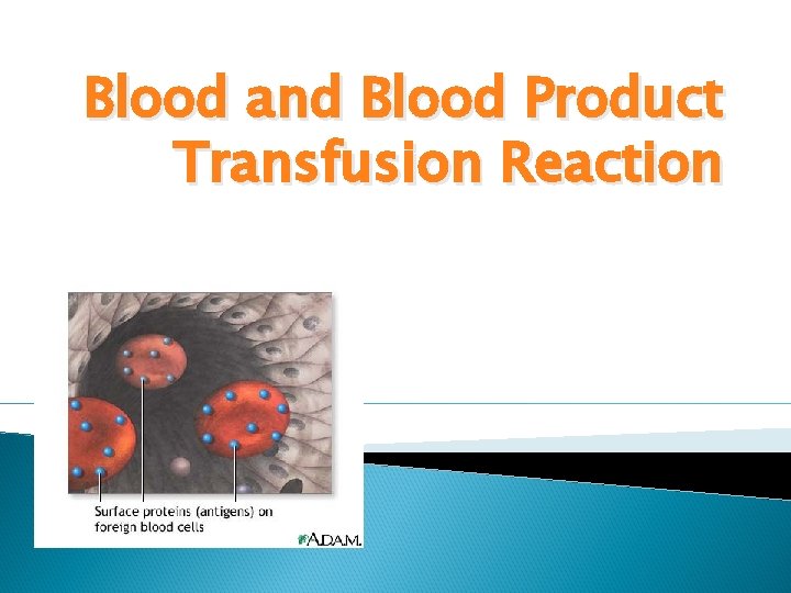 Blood and Blood Product Transfusion Reaction 