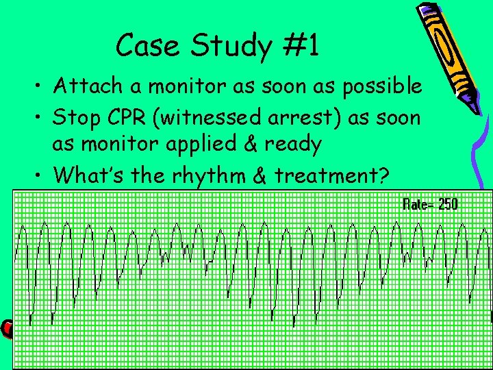 Case Study #1 • Attach a monitor as soon as possible • Stop CPR