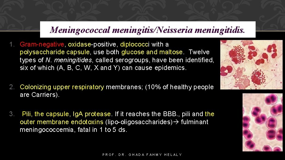 Meningococcal meningitis/Neisseria meningitidis. 1. Gram-negative, oxidase-positive, diplococci with a polysaccharide capsule, use both glucose