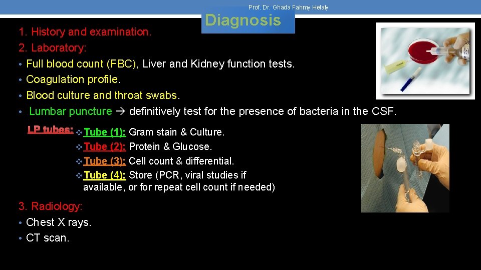 Prof. Dr. Ghada Fahmy Helaly Diagnosis 1. History and examination. 2. Laboratory: • Full