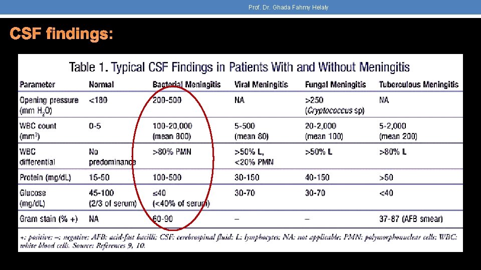 Prof. Dr. Ghada Fahmy Helaly CSF findings: 