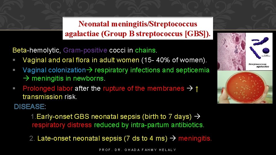Neonatal meningitis/Streptococcus agalactiae (Group B streptococcus [GBS]). Beta-hemolytic, Gram-positive cocci in chains. Vaginal and