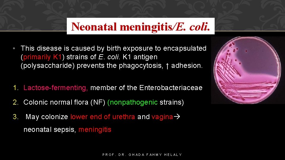 Neonatal meningitis/E. coli. • This disease is caused by birth exposure to encapsulated (primarily
