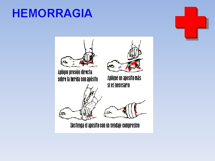 HEMORRAGIA 