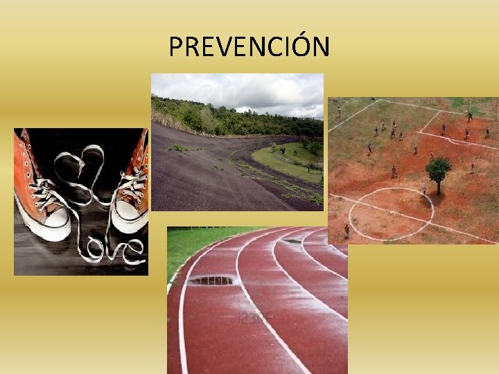 PREVENCIÓN 