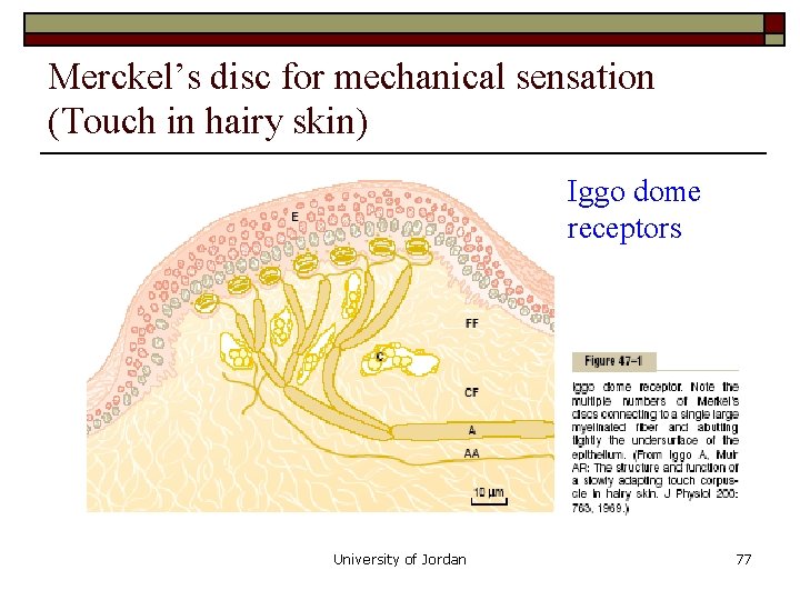 Merckel’s disc for mechanical sensation (Touch in hairy skin) Iggo dome receptors University of Merckel’s disc for mechanical sensation (Touch in hairy skin) Iggo dome receptors University of