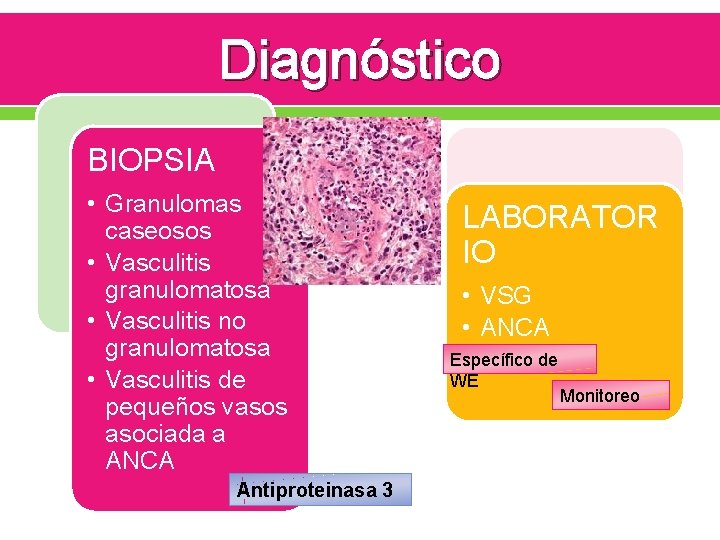 Diagnóstico BIOPSIA • Granulomas caseosos • Vasculitis granulomatosa • Vasculitis no granulomatosa • Vasculitis