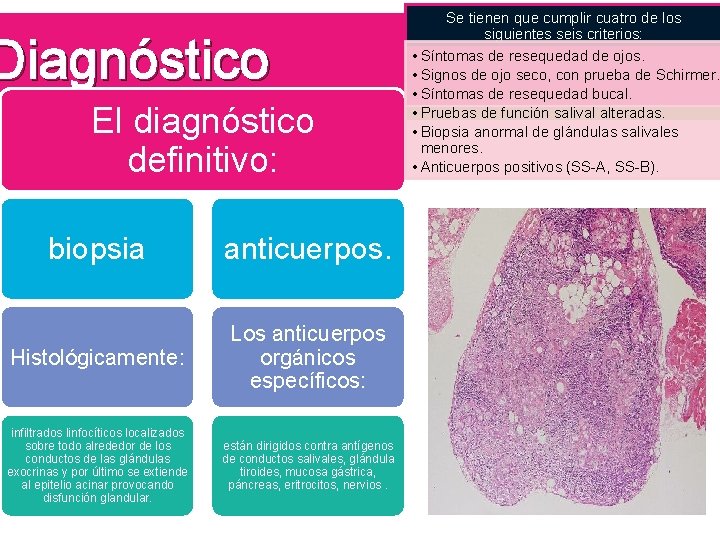 Diagnóstico El diagnóstico definitivo: biopsia anticuerpos. Histológicamente: Los anticuerpos orgánicos específicos: infiltrados linfocíticos localizados