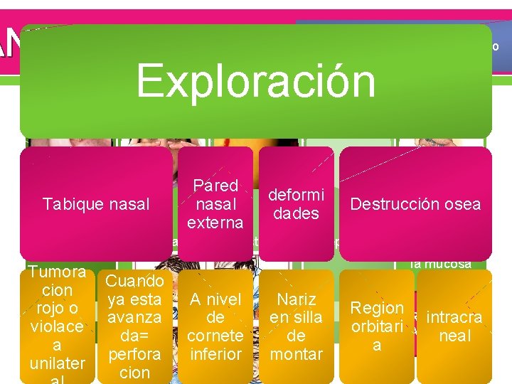 ANIFESTACIONES mayor afección es el tabique cartilaginoso, los cornetes y el piso nasal Exploración