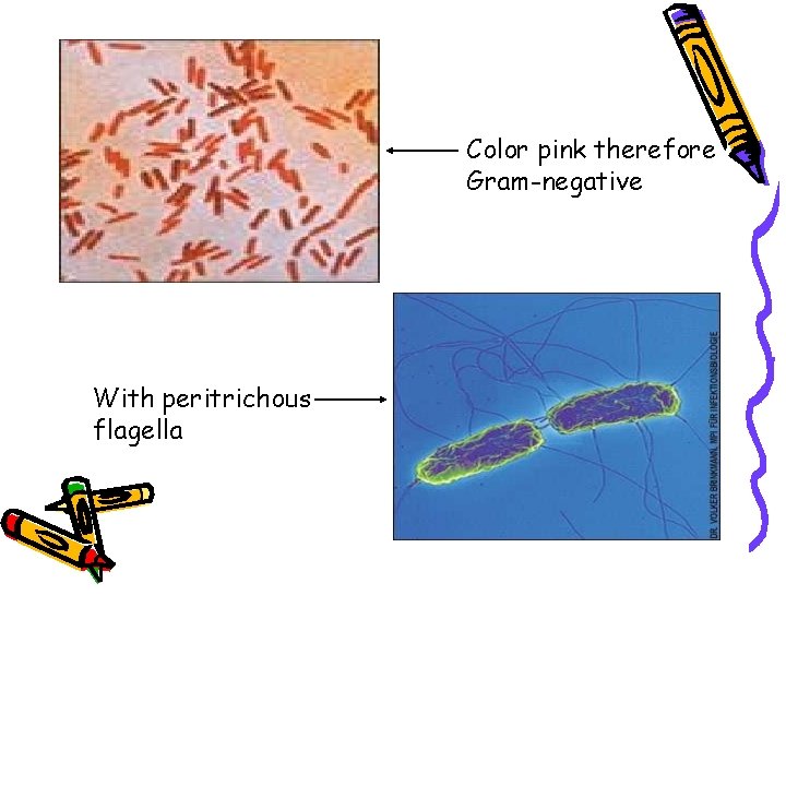 Color pink therefore Gram-negative With peritrichous flagella 