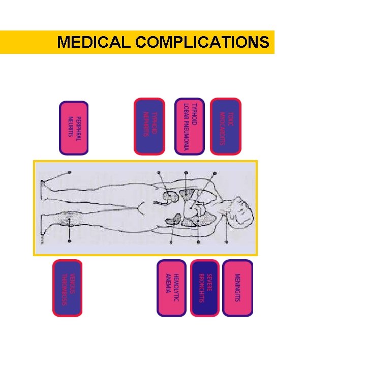 MEDICAL COMPLICATIONS 