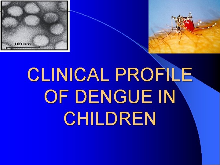 CLINICAL PROFILE OF DENGUE IN CHILDREN 