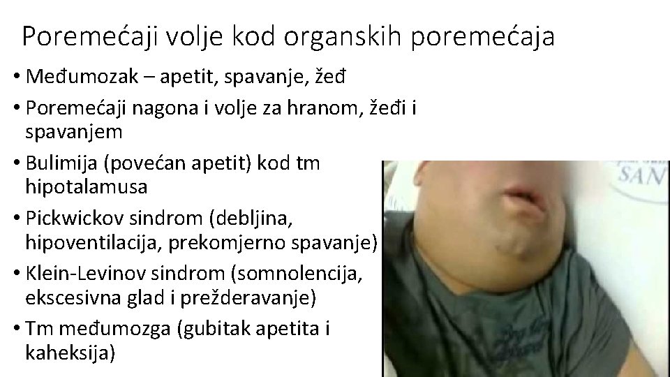 Poremećaji volje kod organskih poremećaja • Međumozak – apetit, spavanje, žeđ • Poremećaji nagona