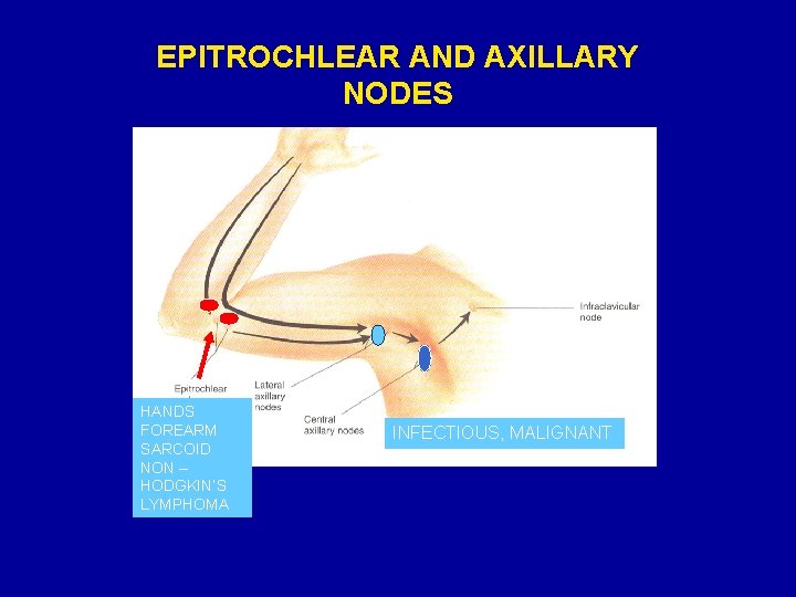 EPITROCHLEAR AND AXILLARY NODES HANDS FOREARM SARCOID NON – HODGKIN’S LYMPHOMA INFECTIOUS, MALIGNANT 