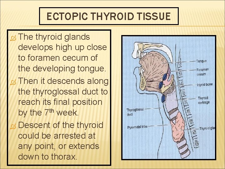 ECTOPIC THYROID TISSUE The thyroid glands develops high up close to foramen cecum of