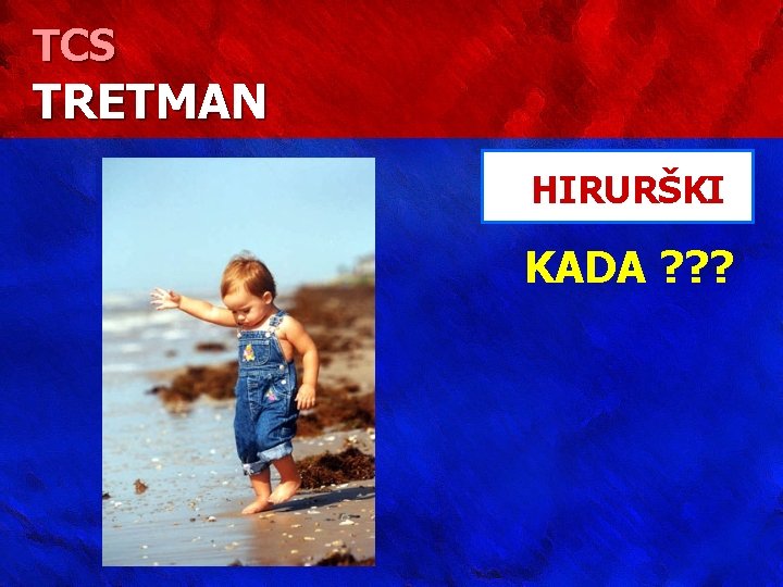 TCS TRETMAN HIRURŠKI KADA ? ? ? 