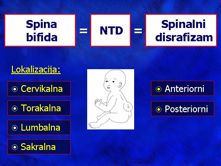 Spina bifida = NTD = Spinalni disrafizam Lokalizacija: Cervikalna Anteriorni Torakalna Posteriorni Lumbalna Sakralna