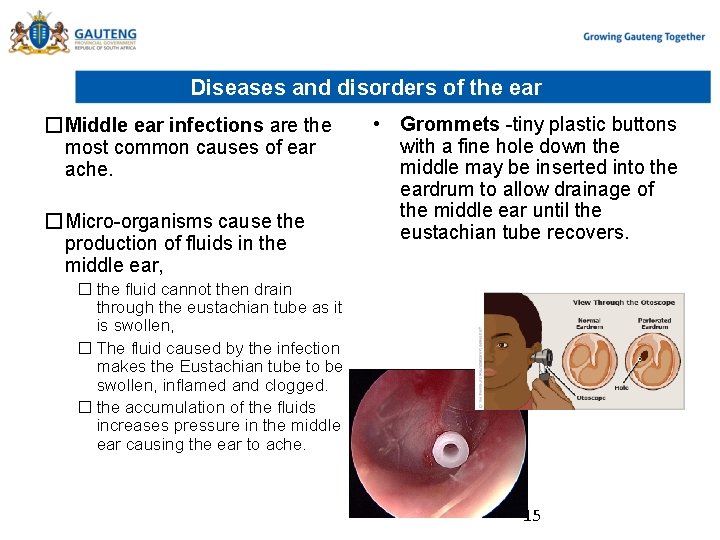 Diseases and disorders of the ear �Middle ear infections are the most common causes