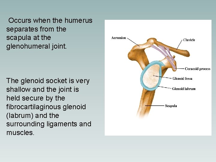 Occurs when the humerus separates from the scapula at the glenohumeral joint. The glenoid