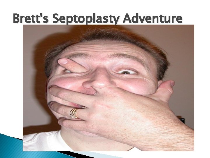 Brett's Septoplasty Adventure 