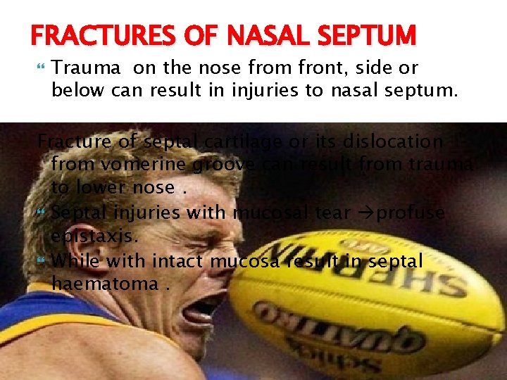 FRACTURES OF NASAL SEPTUM Trauma on the nose from front, side or below can