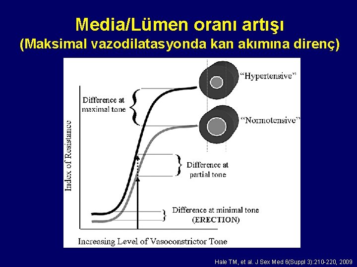 Media/Lümen oranı artışı (Maksimal vazodilatasyonda kan akımına direnç) Hale TM, et al. J Sex