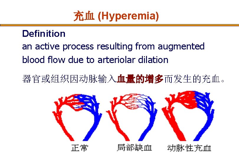 充血 (Hyperemia) Definition an active process resulting from augmented blood flow due to arteriolar