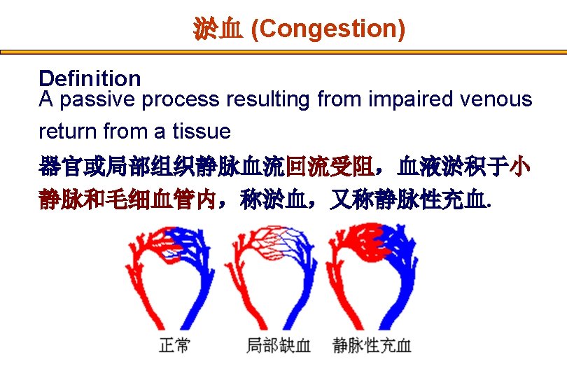 淤血 (Congestion) Definition A passive process resulting from impaired venous return from a tissue
