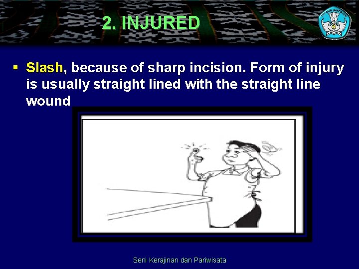 2. INJURED § Slash, because of sharp incision. Form of injury is usually straight